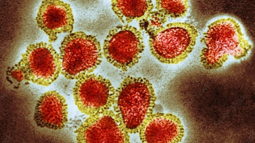Gripe, Influenza A H3N2