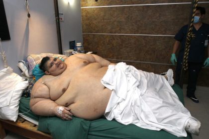 obesidad Juan Pedro Franco