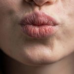 beso