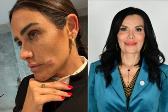 Alessandra Rojo De la Vega sufre agresión | Especial