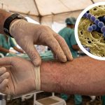 bacteria come carne