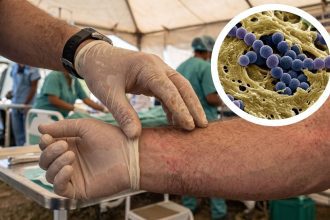 bacteria come carne