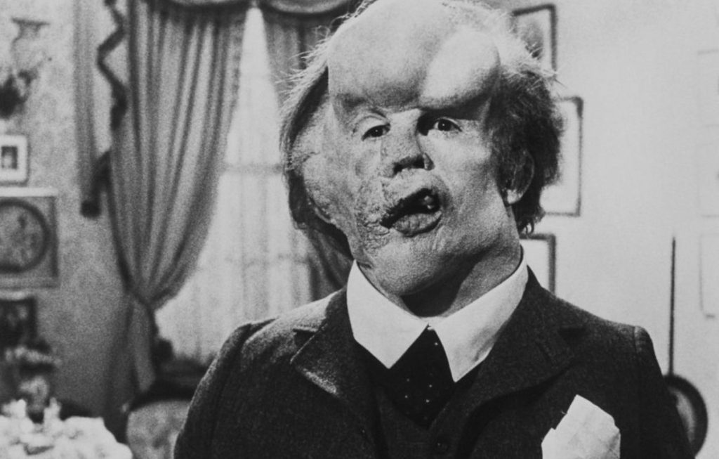 the elephant man lynch