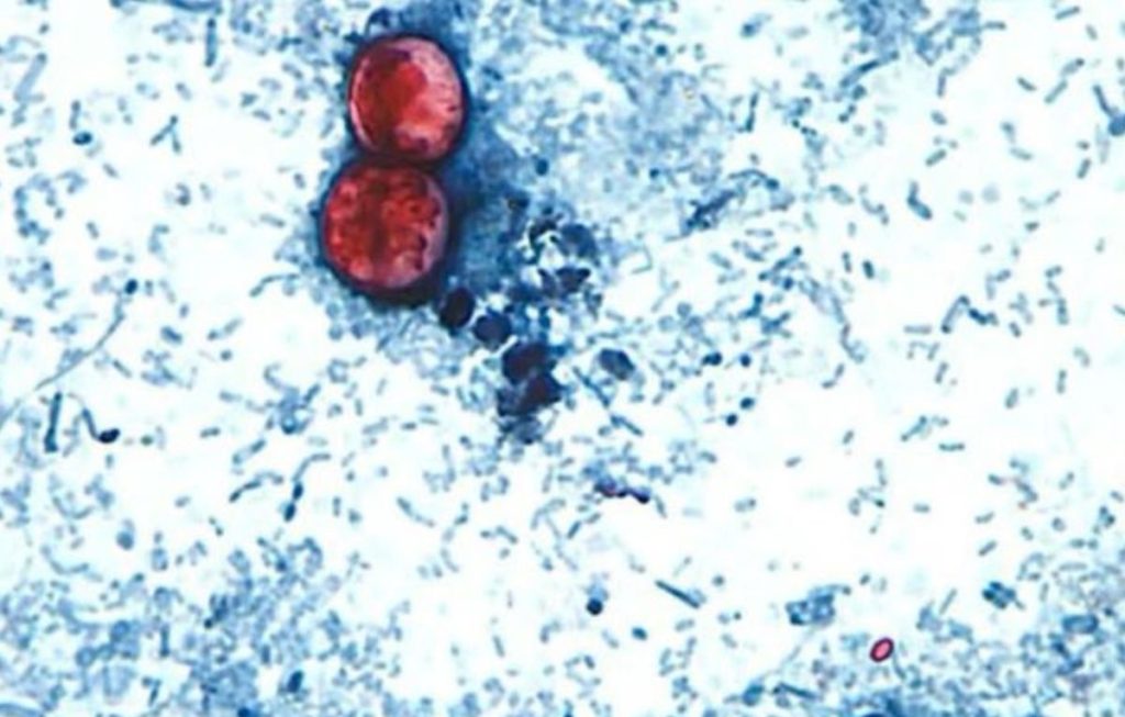 cyclospora